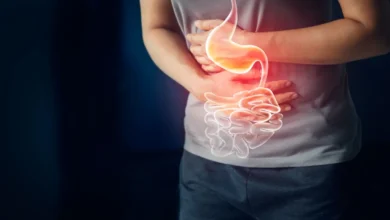 زيادة إفراز حمض المعدة أرشيفية