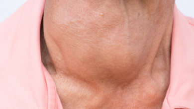 الغدة الدرقية