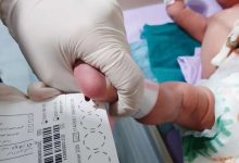 الكشف عن الأمراض الوراثية