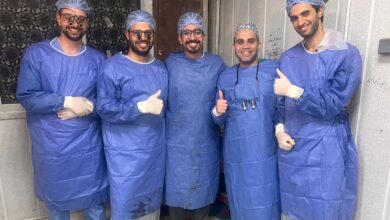 إعادة توصيل يد مبتورة