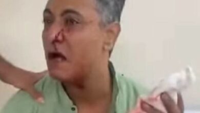 مشاجرة بالمجمع الطبي بالإسماعيلية