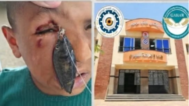 مستشفى عيون جامعة المنيا