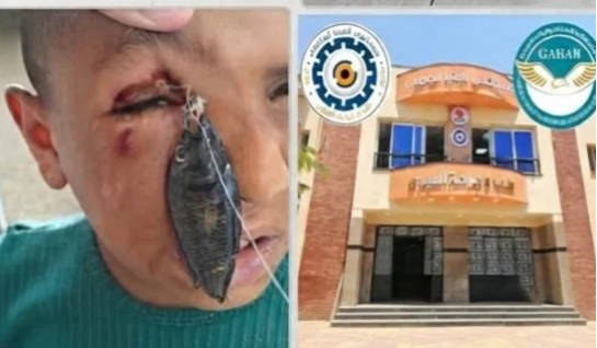 مستشفى عيون جامعة المنيا
