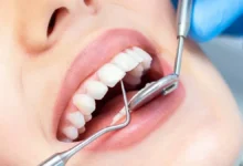 خريجي طب الأسنان