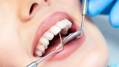 خريجي طب الأسنان