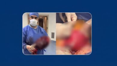 جراحة استثنائية تنقذ مريضًا