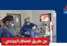 نجاح جراحة دقيقة بالمنظار