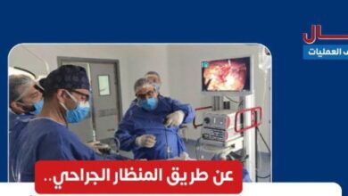 نجاح جراحة دقيقة بالمنظار