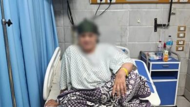 50 جرعة مصل تنقذ سيدة من لدغة ثعبان
