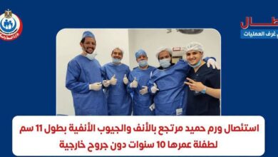 نجاح استئصال ورم حميد