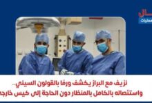 إنجاز طبي بمركز كبد ههيا