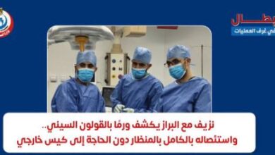 إنجاز طبي بمركز كبد ههيا