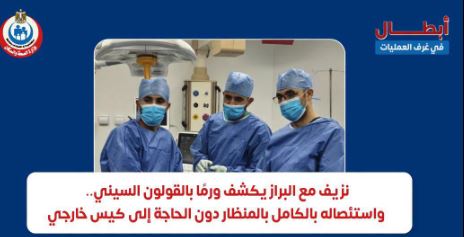 إنجاز طبي بمركز كبد ههيا